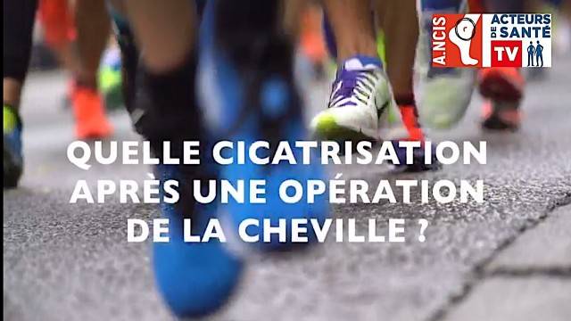 Quelle cicatrisation après une opération de la cheville ?